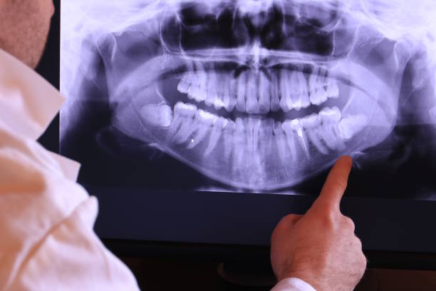 Best Dentist for Tooth Abscess  in Suffolk, VA