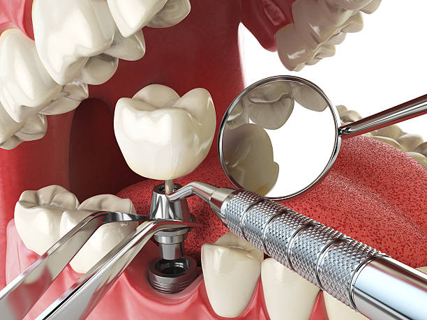 Best Knocked-Out Tooth Emergency  in Suffolk, VA